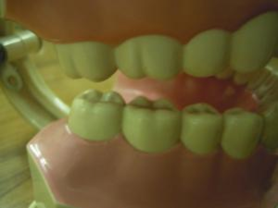 COLGATE DİŞ MODELİ AĞIZ DİŞ MODELİ ÖĞRENCİ ÇALIŞMA MODELİ ÇOCUK DİŞ ÇEKİLEBİLİR 