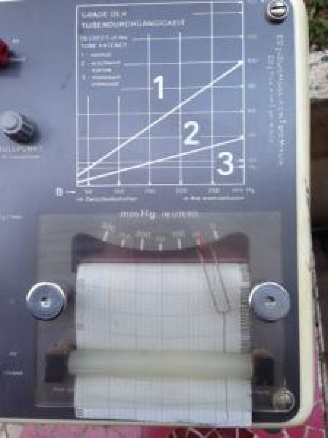 WİSAP UNUVERSAL Co2-PNEU INSUFFATÖR TIP OPERASYON VAKUM ALETİ 
